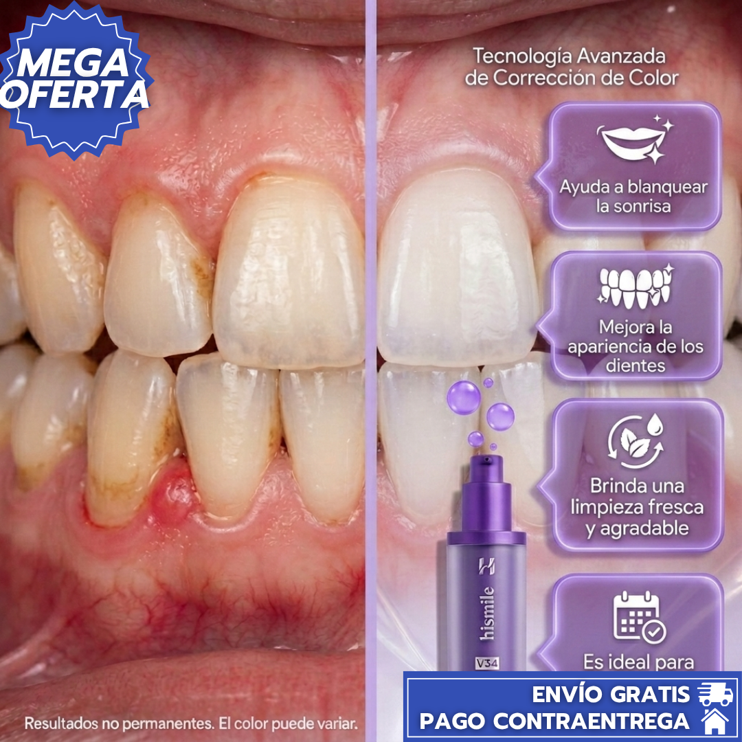 OFERTA:HiSmile™2X1: Pasta Dental Blanqueadora de Acción Suave que Elimina Manchas Superficiales y Realza el Brillo Natural de tu Sonrisa.